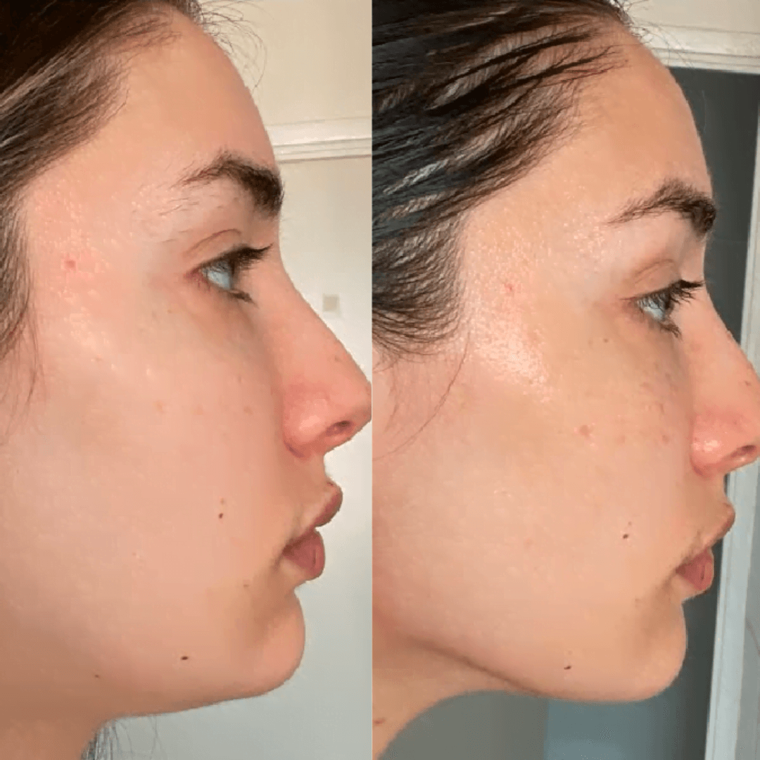 Livaé – Massage facial chauffant & 7 lumières LED pour une peau éclatante