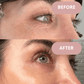 Ephylift - Kit visage - 5 patchs