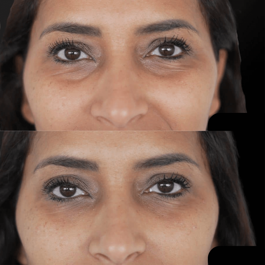 Livaé – Massage facial chauffant & 7 lumières LED pour une peau éclatante