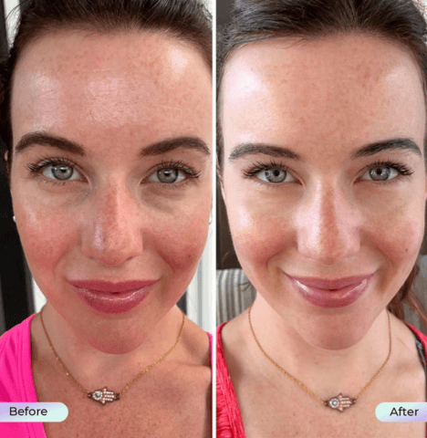 SkinAura | The light that reveals your beauty