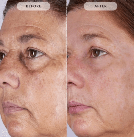 SkinAura | The light that reveals your beauty