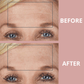 Ephylift - Kit para rostro, cuello y escote - 11 parches