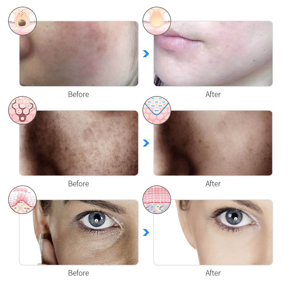 SkinAura – La Lumière qui révèle votre beauté